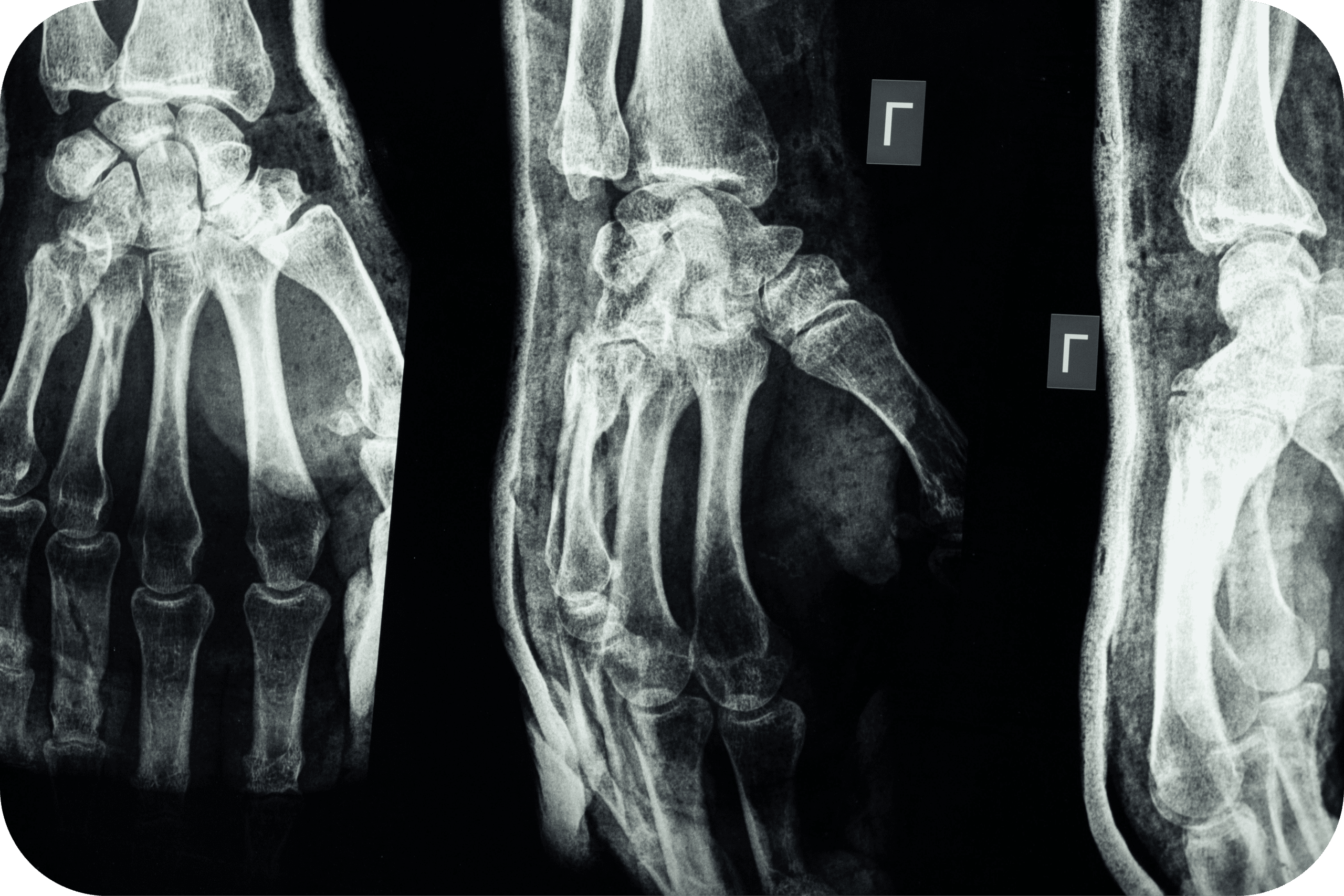 Medical image Medical image